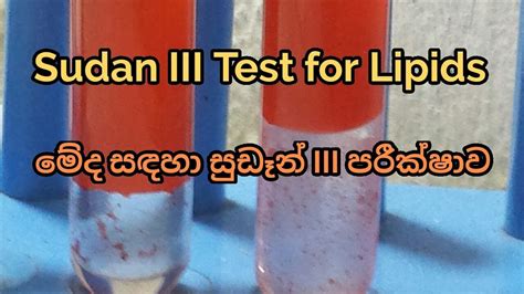 test for lipids sudan iii